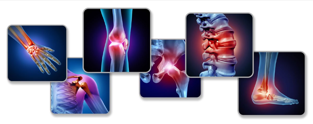 Joint Pains