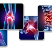 iStock 1171639646 scaled